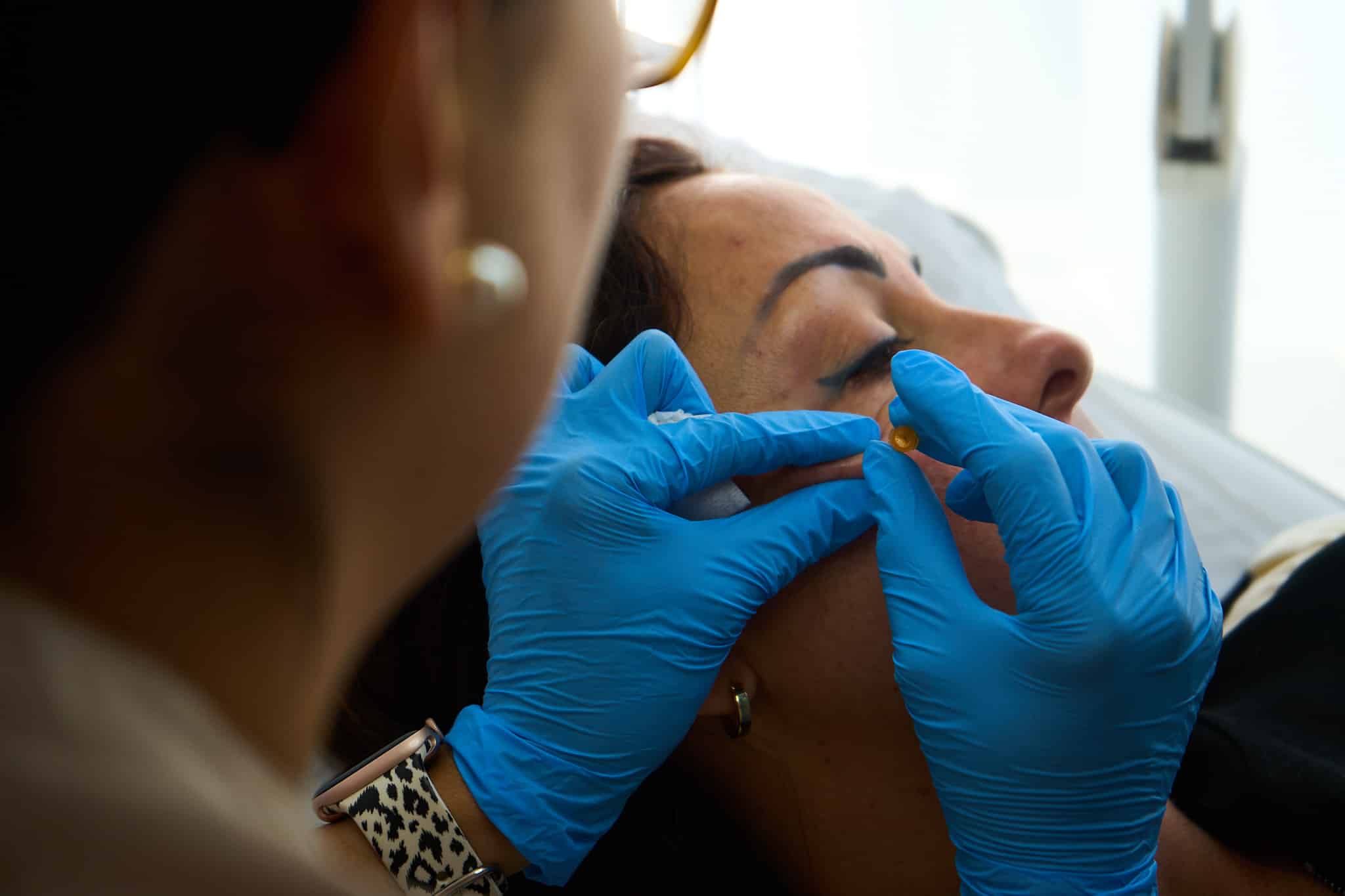 Medicina estética en Conil